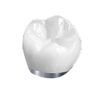 Металло-керамика