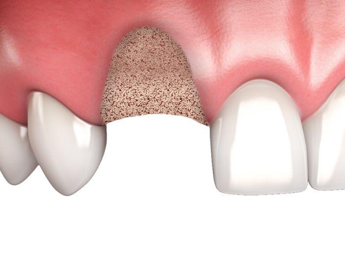 Комбинированные материалы (смешанные составы)