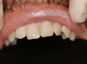 Результаты работ наших специалистов эстетика после